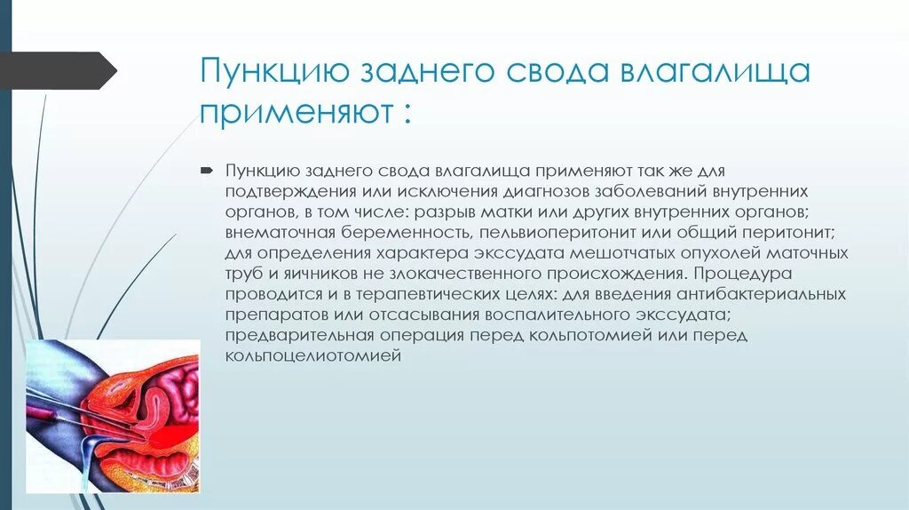 Почему после задней