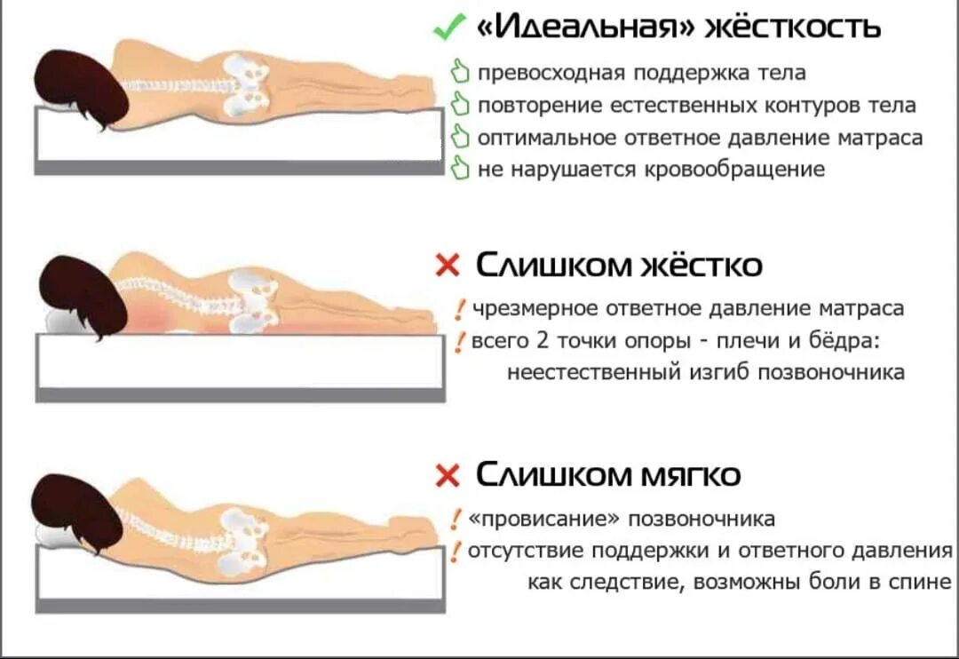 Болит спина от матраса. Правильное положение позвоночника на матрасе. Матрас при остеохондрозе поясничного отдела позвоночника. Правильное положение сна на спине. Правильное положение позвоночника во сне.