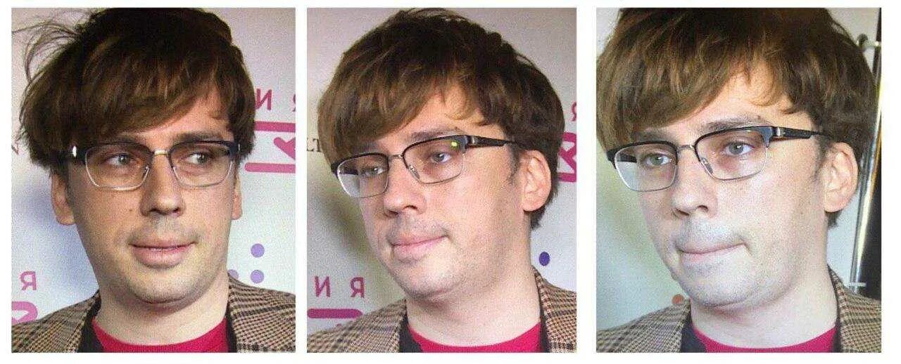 Мочки ушей у евреев. Синяк под глазом масоны. Синяк под глазом масоны. Обама рептилоид. Синяк под глазом масоны.