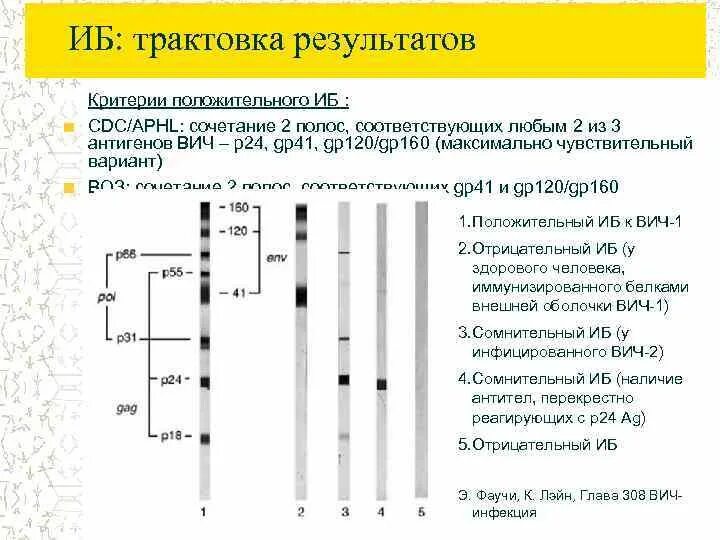 Антитела к ВИЧ 1.2 антиген р24. Интерпретация результатов. Лабораторный анализ ВИЧ инфекция. Трактовка результатов. Тест антиген вич