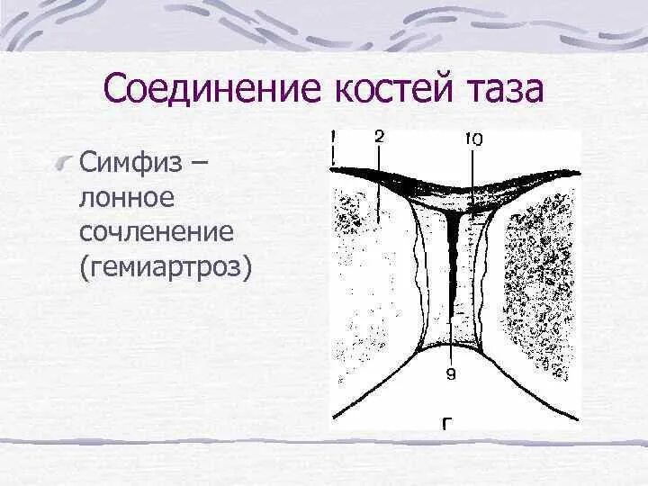 Лобковые кости соединение. Симфиз. Симфизы соединения костей. Лонное соединение. Симфиз рисунок.