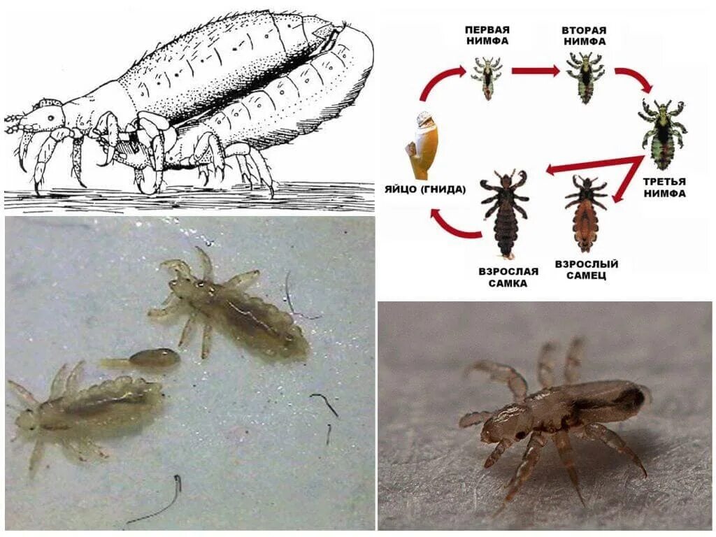 Life-cycle of the head louse. A female louse lays 50-150 eggs during... Download