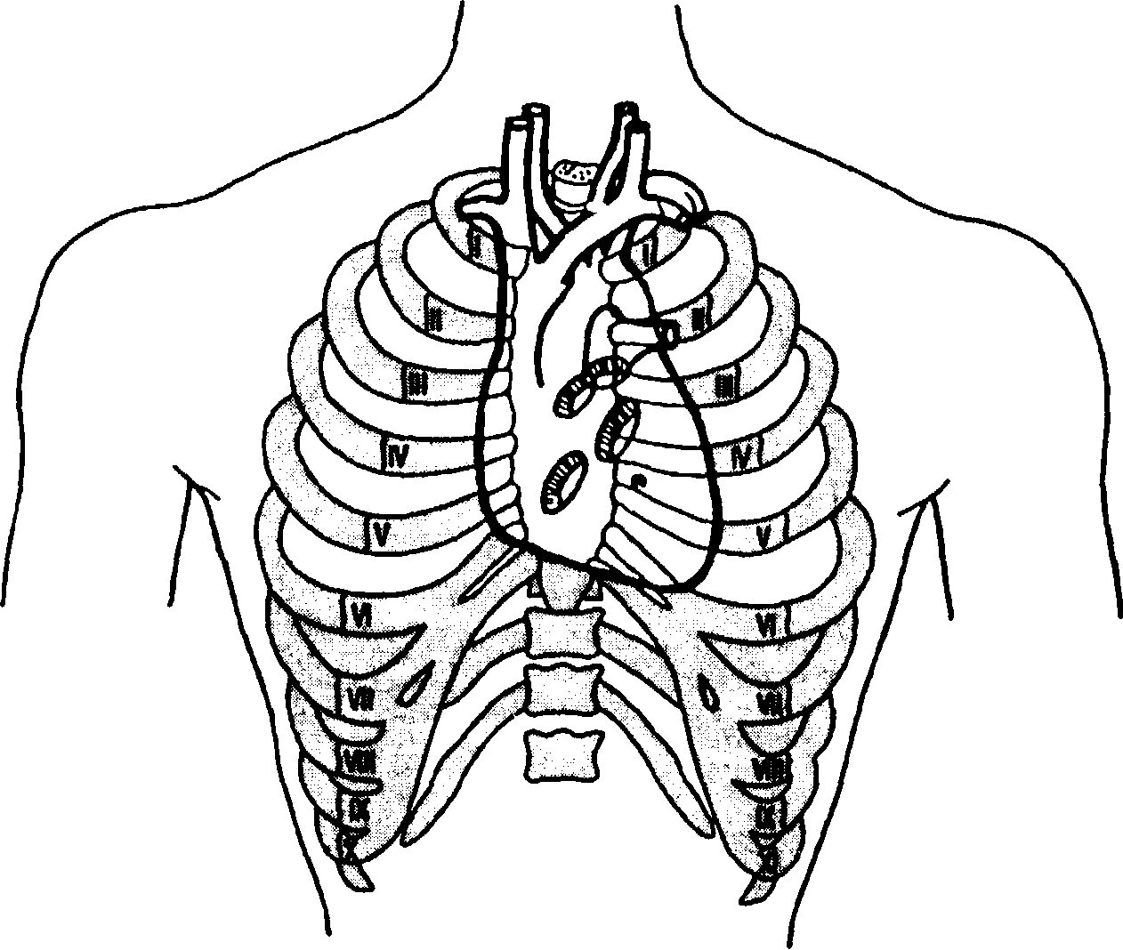 Межреберья грудной клетки. Грудная клетка человека межреберья. Топография выслушивания клапанов сердца. Грудная клетка человека анатомия межреберье. Клапаны сердца на грудной клетке