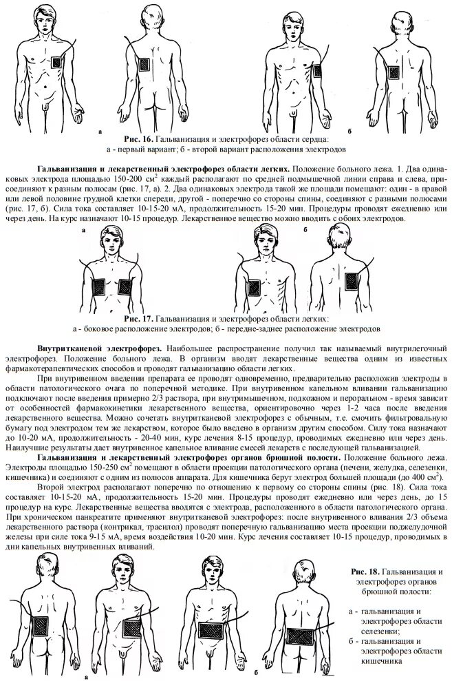 Электрофорез по ратнеру методика. Методики гальванизации в физиотерапии. метод наложение электродов при гальванизации:. методика наложения электродов в физиотерапии. методика проведения лекарственного электрофореза.