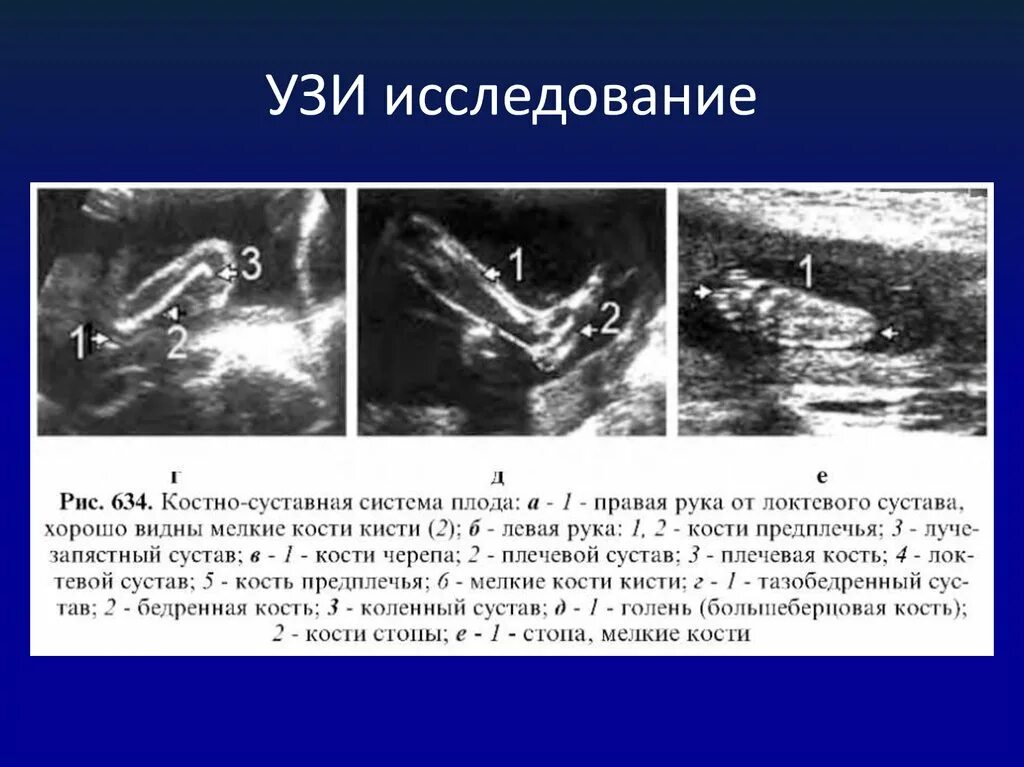 Укорочение трубчатых