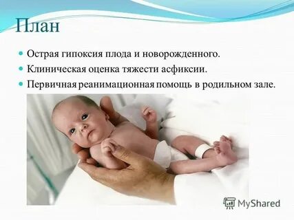 Гипоксия у новорожденных