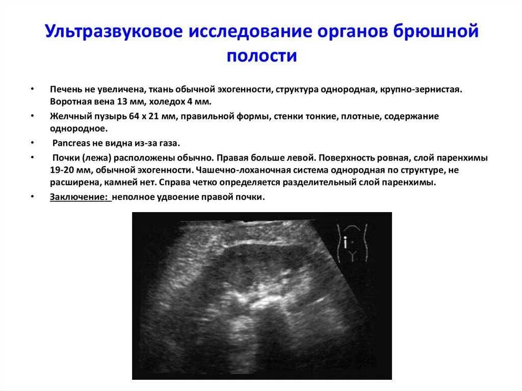 Узи полные органов. Ультразвуковое исследование брюшной полости комплексное. Ультразвуковое исследование органов брюшной полости проводится в. УЗИ органов брюшной полости требует специальной пациента. Показания для ультразвукового исследования органов брюшной полости:.