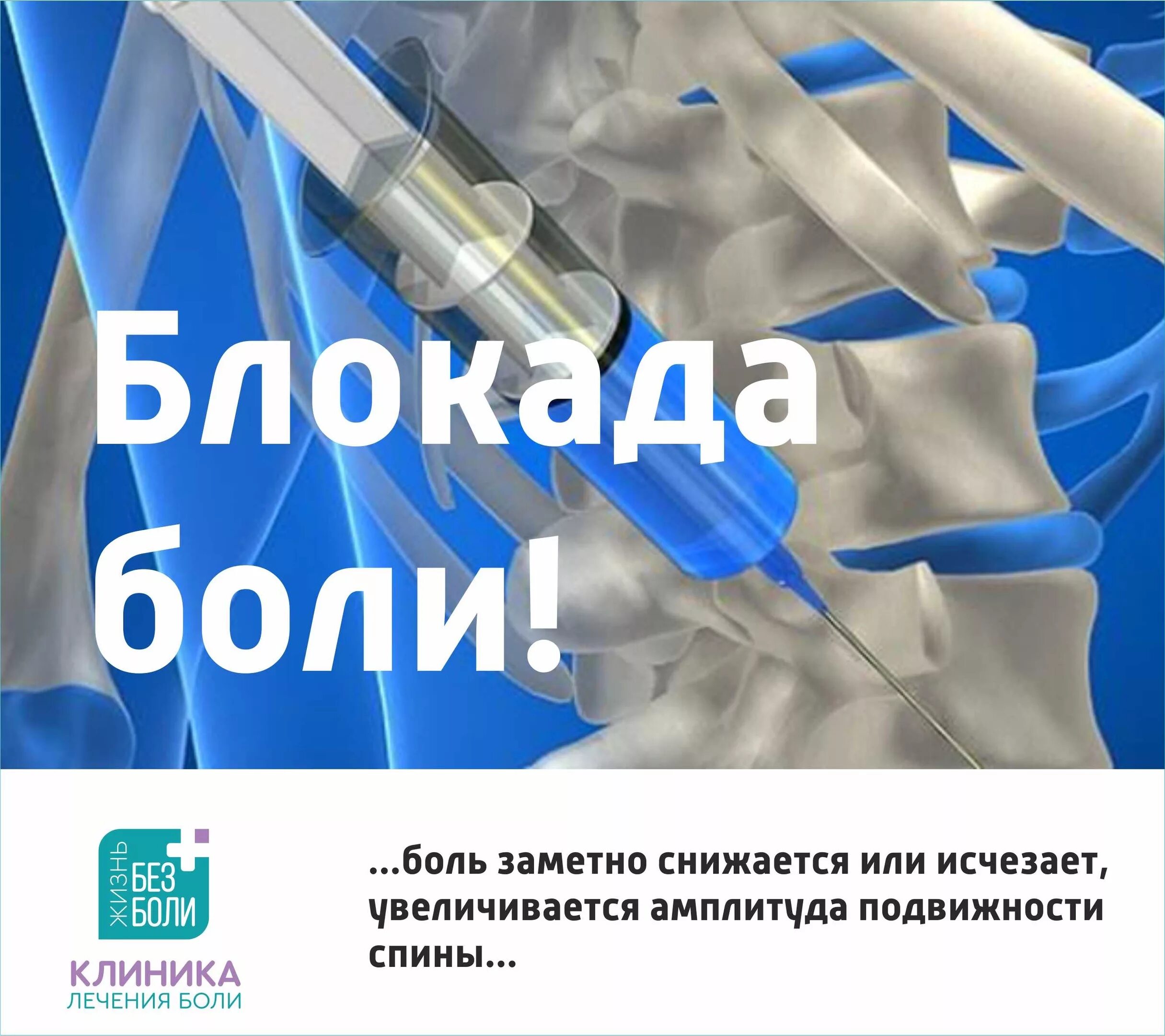 Можно ли ставить блокаду