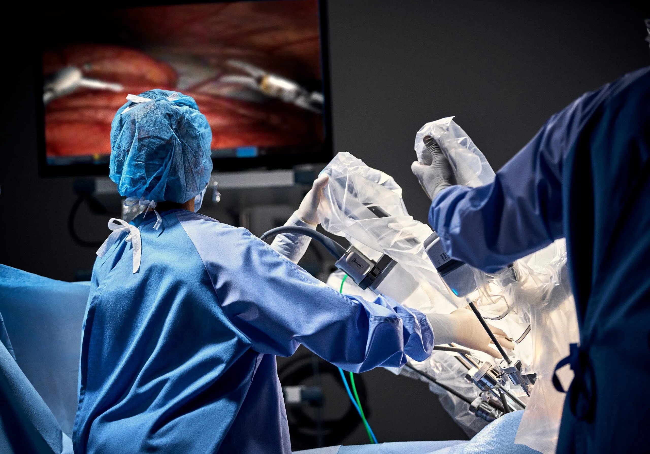 Робот делает операцию. Робот da Vinci XI. Робот хирург да Винчи. Хирургический робот DAVINCI. DAVINCI робот хирургия.