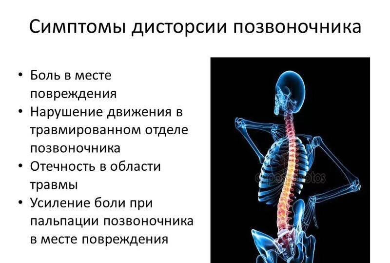 Дисторсия грудного отдела позвоночника. Симптомы повреждения позвонка в грудном отделе. Повреждение шейного отдела позвоночника симптомы. Дисторсия шейного отдела позвоночника.