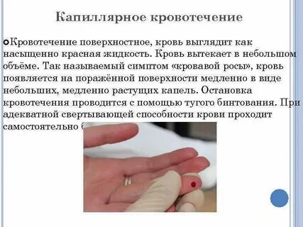 Кровотечение длилось