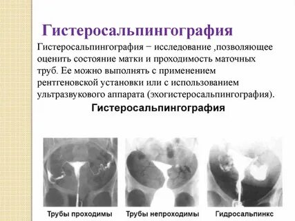 На какой день цикла проверяют проходимость