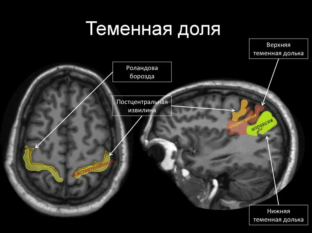 Лобные извилины мрт анатомия. Доли головного мозга на кт анатомия. Доли головного мозга мрт анатомия.