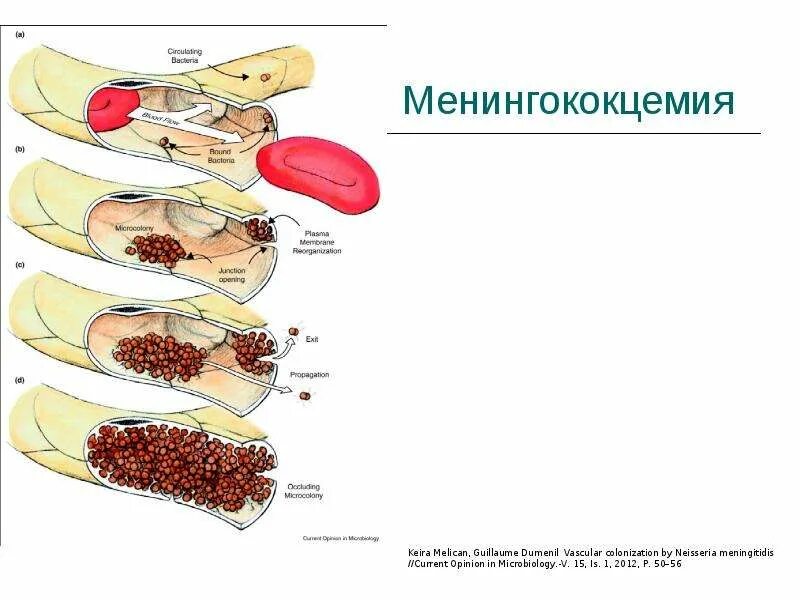 Менингококковая сыпь у детей как выглядит Отсутствие прививок от кори подвергают опасности Буйнакск