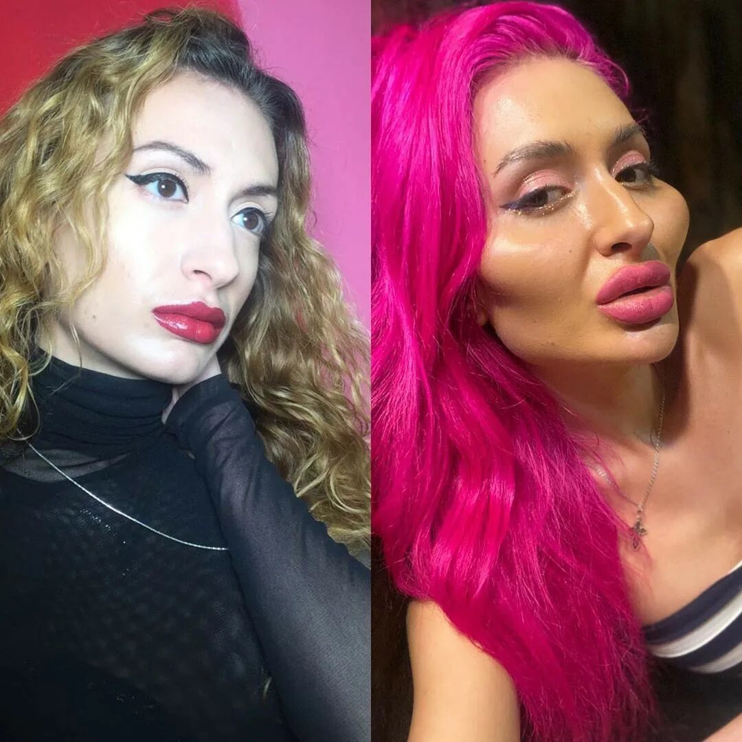 Силиконовые губы. Женщина с большими губами. Форум большие губы. Форум большие губы. Силиконовые губы.