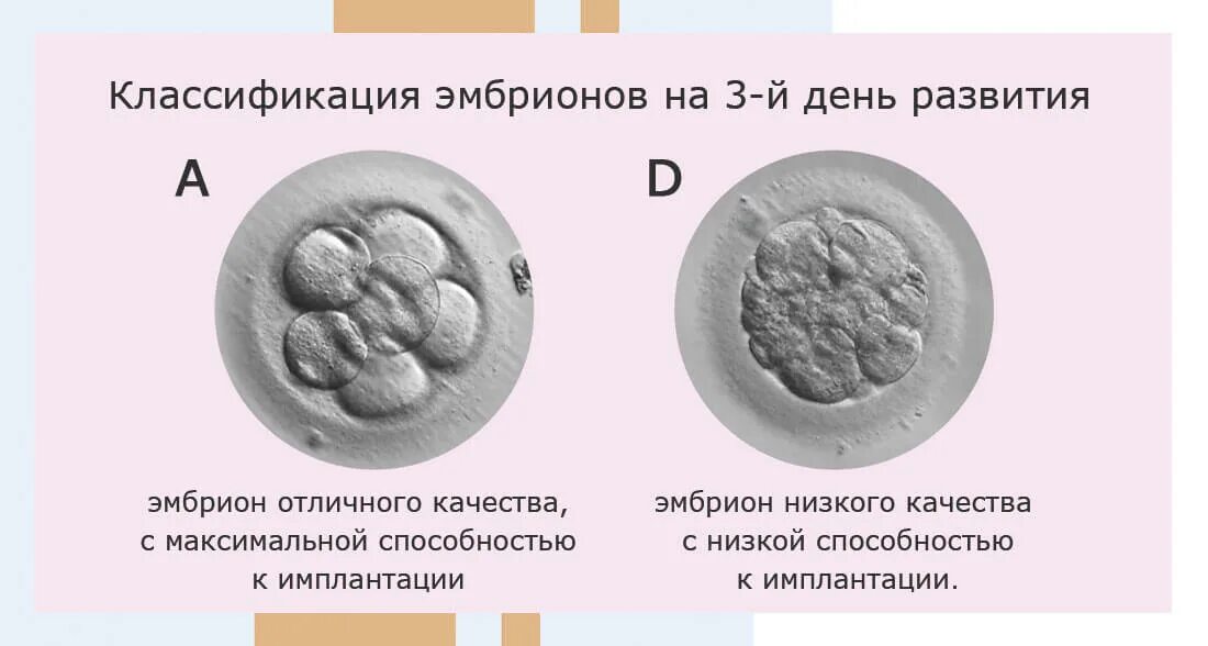 Эмбрион после пересадки. Классификация качества эмбрионов. Оценка качества эмбрионов. Эмбрион 5 дней.