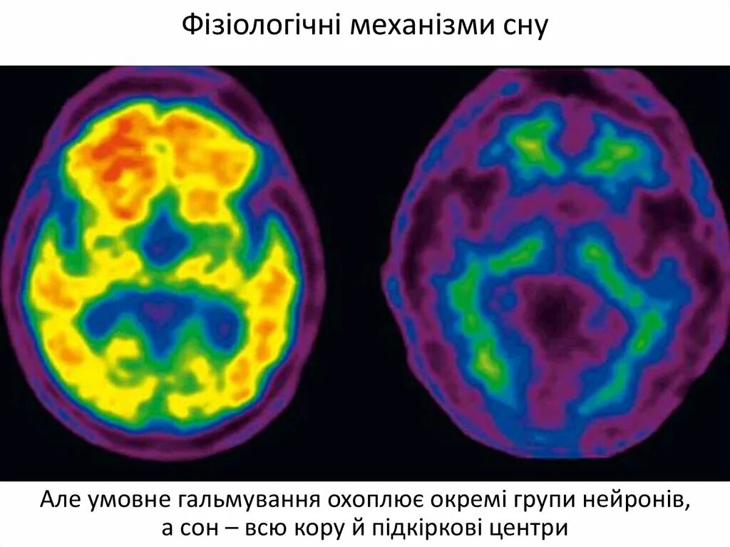 Процесс торможения в коре головного мозга. Торможение в коре головного мозга. Процессы торможения в коре головного мозга. Возбуждение в коре головного мозга. Возбуждение и торможение головного мозга.