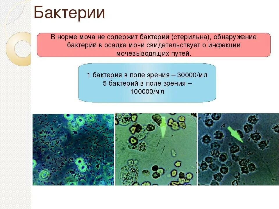 Микроорганизмы выявлен. Бактерии в моче. микроорганизмы в моче. бактерии в моче у женщин. бактерии в моче при микроскопии.