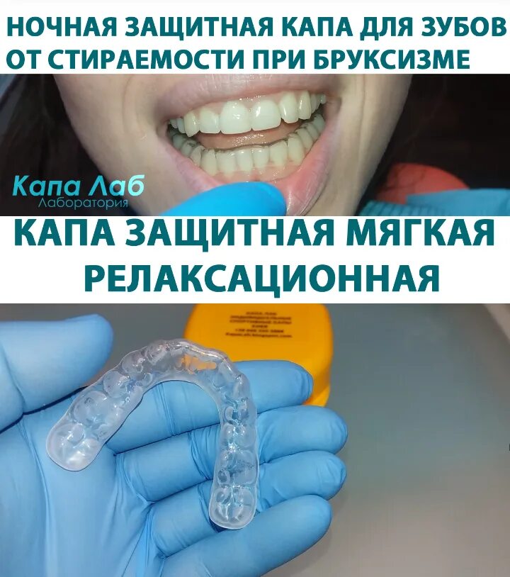 Капа для зубов fusion 360. Элайнеры invisalign. Капа для кабеля epke-0084. Каппа отбеливания зубов white light. Капа миобрейс т2.