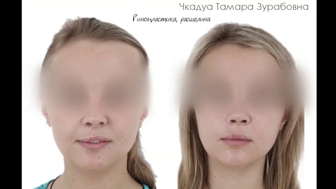 Пластические операции детям