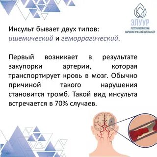 Инсульт 2022