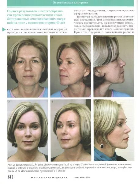 пластическая хирургия владивосток. мошак пластический хирург владивосток. колумелла носа ринопластика. сергей мошак. эндоскопический лифтинг блефаропластика век.