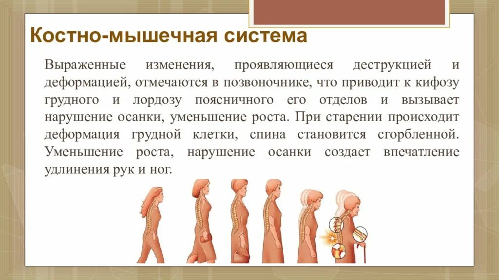 Костно мышечная система у пожилых. Возрастные изменения костно мышечной системы. старение костно-мышечная система человека. возрастные изменения мышц. костно мышечная система у пожилых людей.
