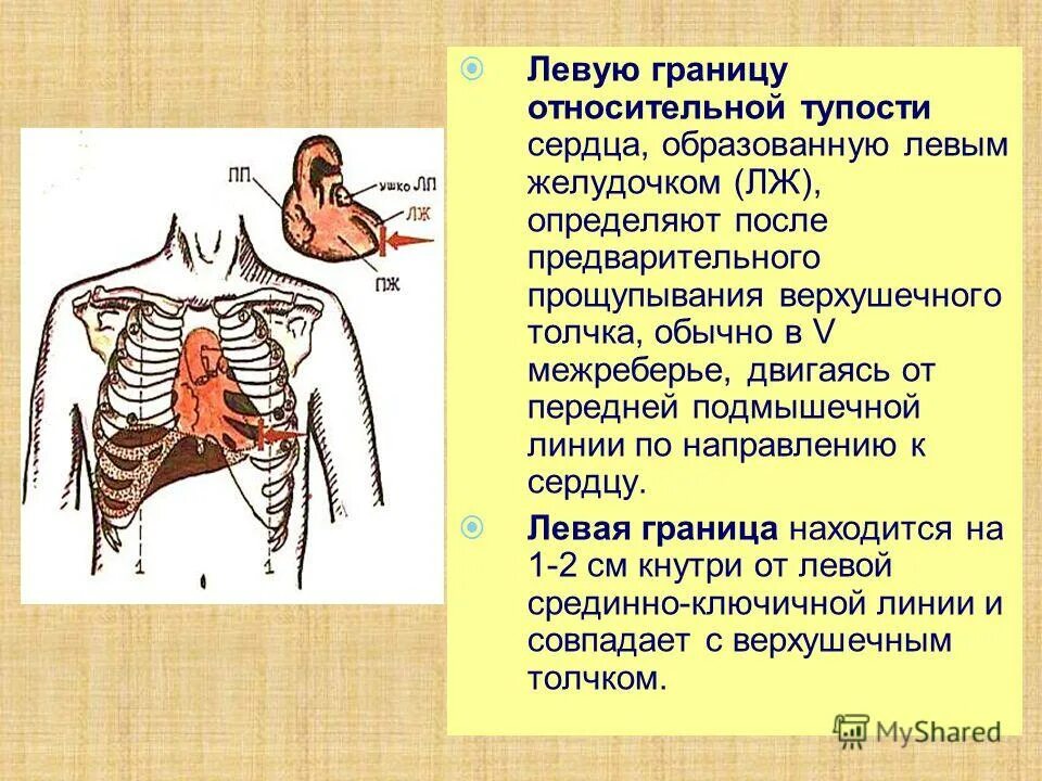 Определение границ относительной тупости сердца. Методика определения границ относительной сердечной тупости. расширение левой границы относительной сердечной тупости причины. левая граница сердца в норме относительной. левая граница относительной сердечной тупости образована.