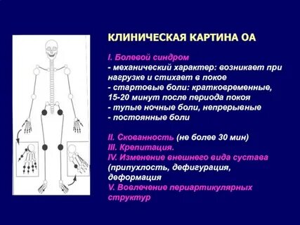 Какая боль при ревматоидном артрите