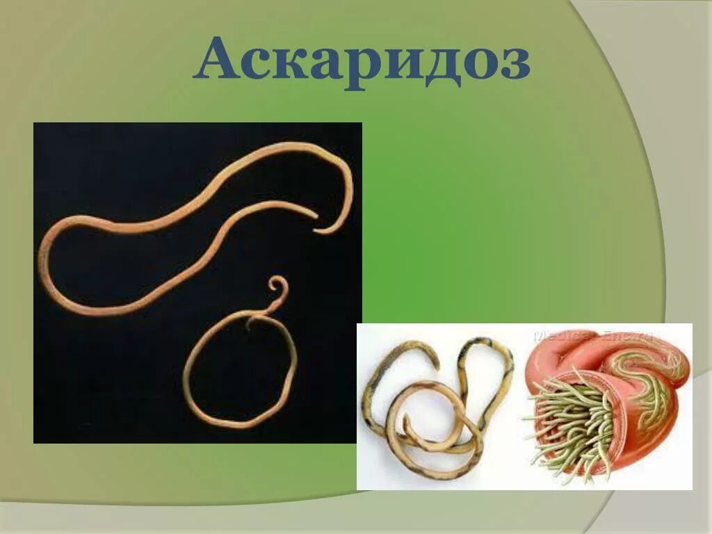 Частый аскаридоз