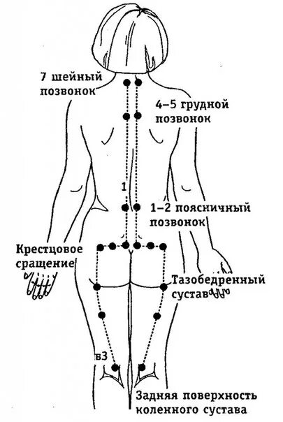 Лимфоузлы на пояснице. Лимфоузлы поясничного отдела схема. Лимфатические узлы на теле женщины схема.