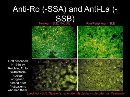 Ssa ro 52