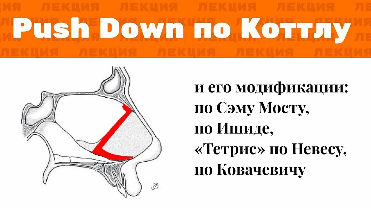 Push push push me down. Push down ринопластика. pushdown ринопластика. caple push down. push down turn to open.