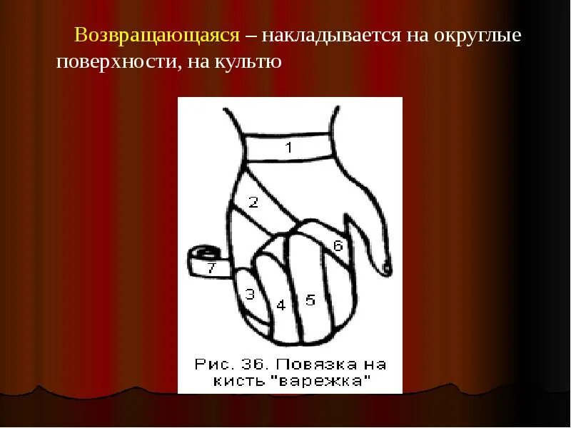 Техника наложения варежки. Десмургия возвращающаяся повязка на кисть. Наложение повязки на культю. Повязка на культю кисти. Наложение возвращающейся повязки на культю.