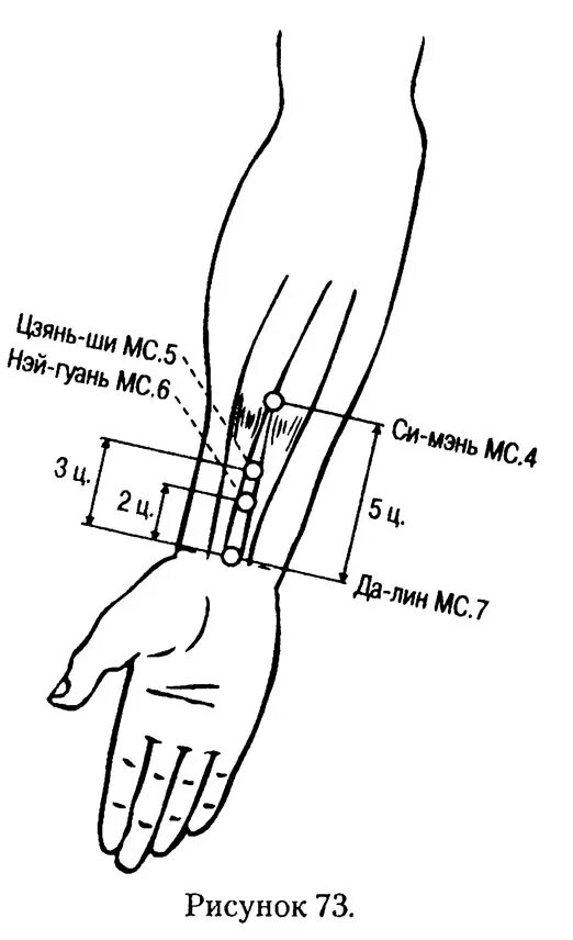 Мс 7 4. Точка мс6 Нэй-Гуань. Mc6 точка акупунктуры. Нэй Гуань точка акупунктуры. Точки 5 (Нэй-Гуань).