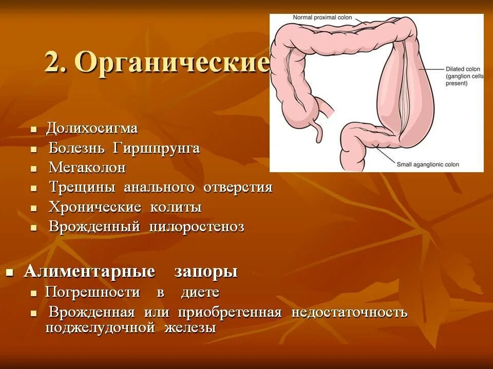 Долихосигма кишечника рентген. Сигмовидная кишка долихосигма. Петля сигмовидной кишки петля. Дополнительная петля сигмовидной кишки. Признаки долихосигмы что это.
