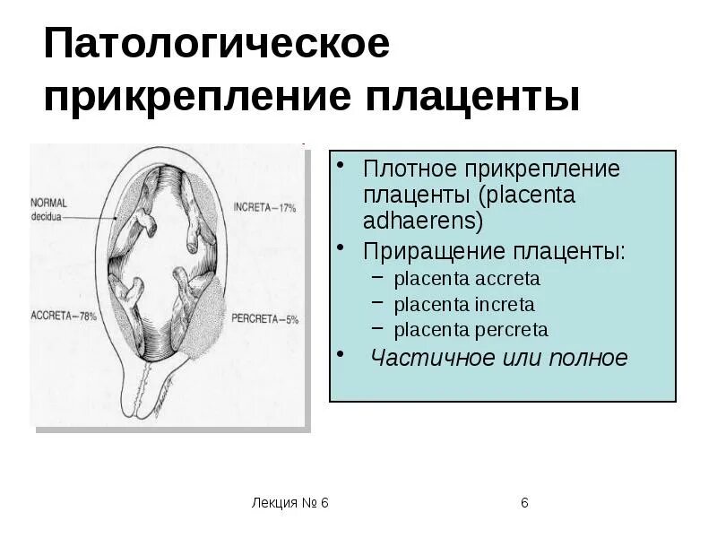 Истинное приращение. Аномалии предлежания плаценты. Диагностические критерии предлежание плаценты. Плотное прикрепление плаценты классификация. Патология локализации плаценты.