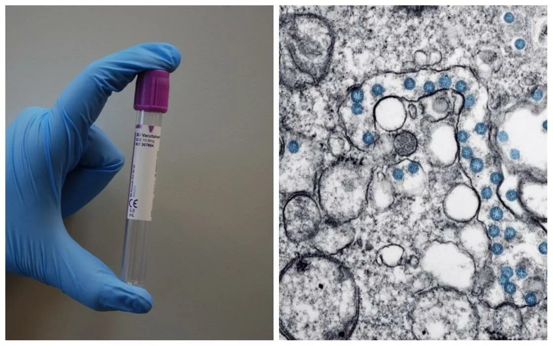 Вирус в пробирке. Пробирки с вирусом гриппа в термостате. Фото коронавируса в пробирке.