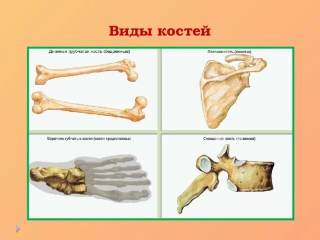 Виды костей. Опорно двигательная система виды костей. Заколки в виде костей. Молоточек кость строение. Ковид кости