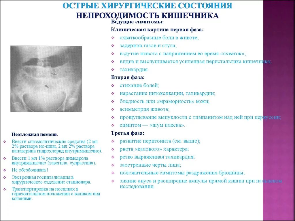Признаки кишечной непроходимости у взрослых. Хирургические симптомы кишечной непроходимости. хирургические симптомы инвагинации кишечника. симптомы при кишечной непроходимости. острая кишечная непроходимость симптомы.