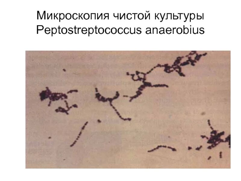 Peptostreptococcus spp