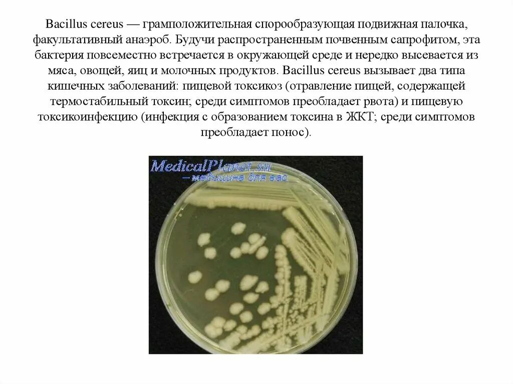 Микроорганизмы образующие споры. Бациллы цереус Bacillus Cereus. Bacillus Cereus микробиология характеристика. Палочка цереус (Bacillus Cereus). Bacillus Cereus (пищевая токсикоинфекция)..