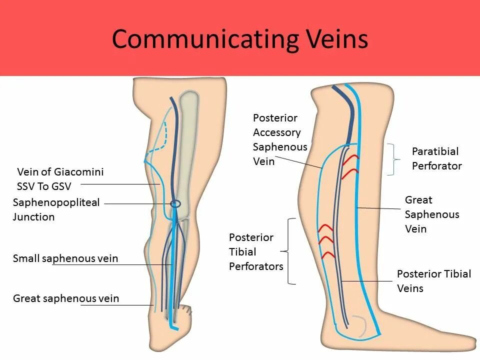 Вена джакомини схема расположения Lower extremity veins Radiology Key Medical anatomy, Medical knowledge, Medical