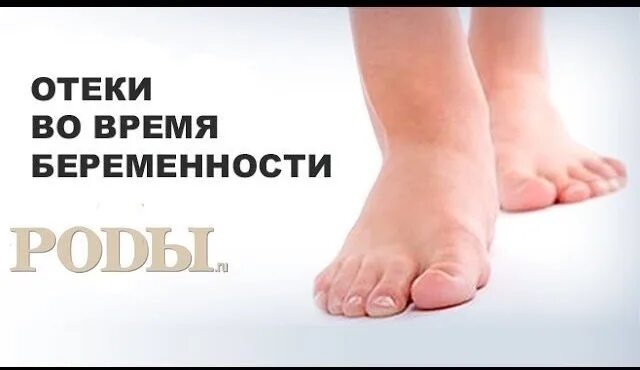 Отекла нога при беременности 2 триместр. Отёки ног при беременности. отекли ноги в беременность.