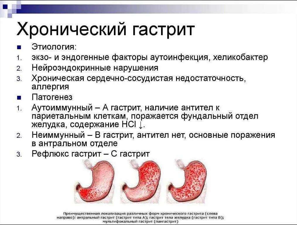Этиология хронического гастрита гастрита. Хронический фундальный гастрит этиология. Рефлюкс гастрит этиология. Причины и механизм развития хронического гастрита