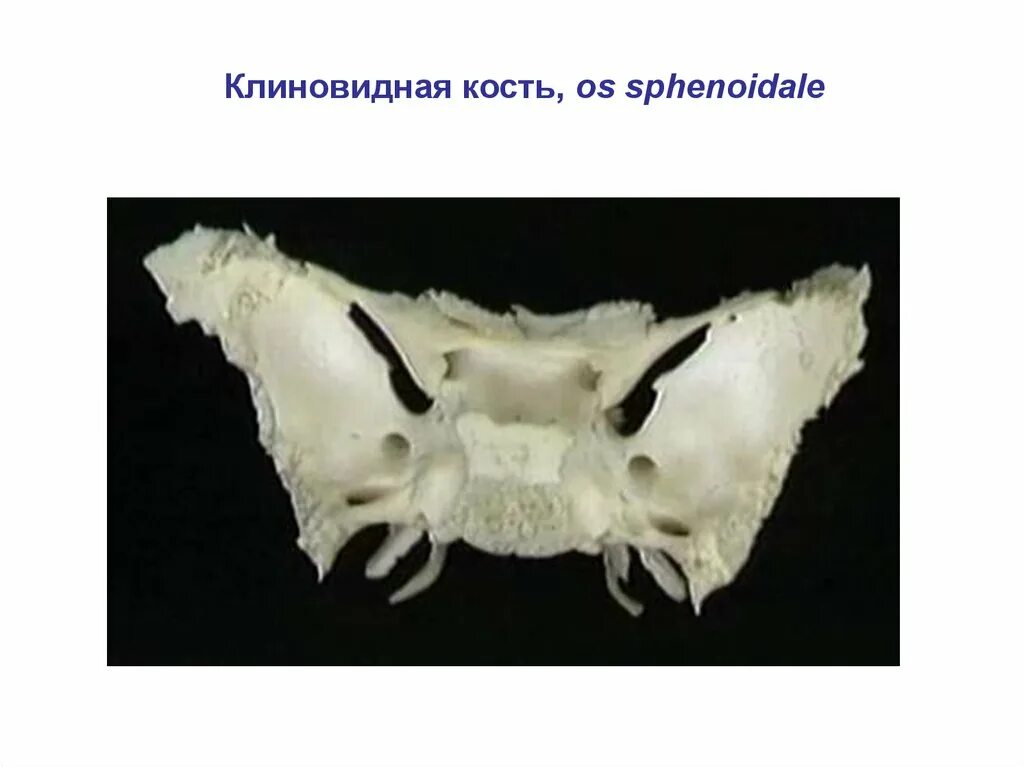 Кость бабочка. Клиновидная кость (os sphenoidale). Клиновидная кость черепа анатомия. Клиновидная кость черепа настоящая. Клиновидная кость анатомия 3 д.