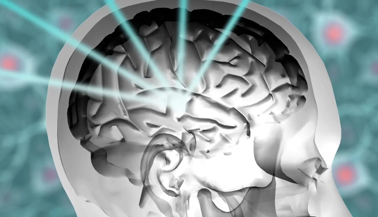 Brain 229. Stereotactic Radiosurgery. Radiation and Brain.