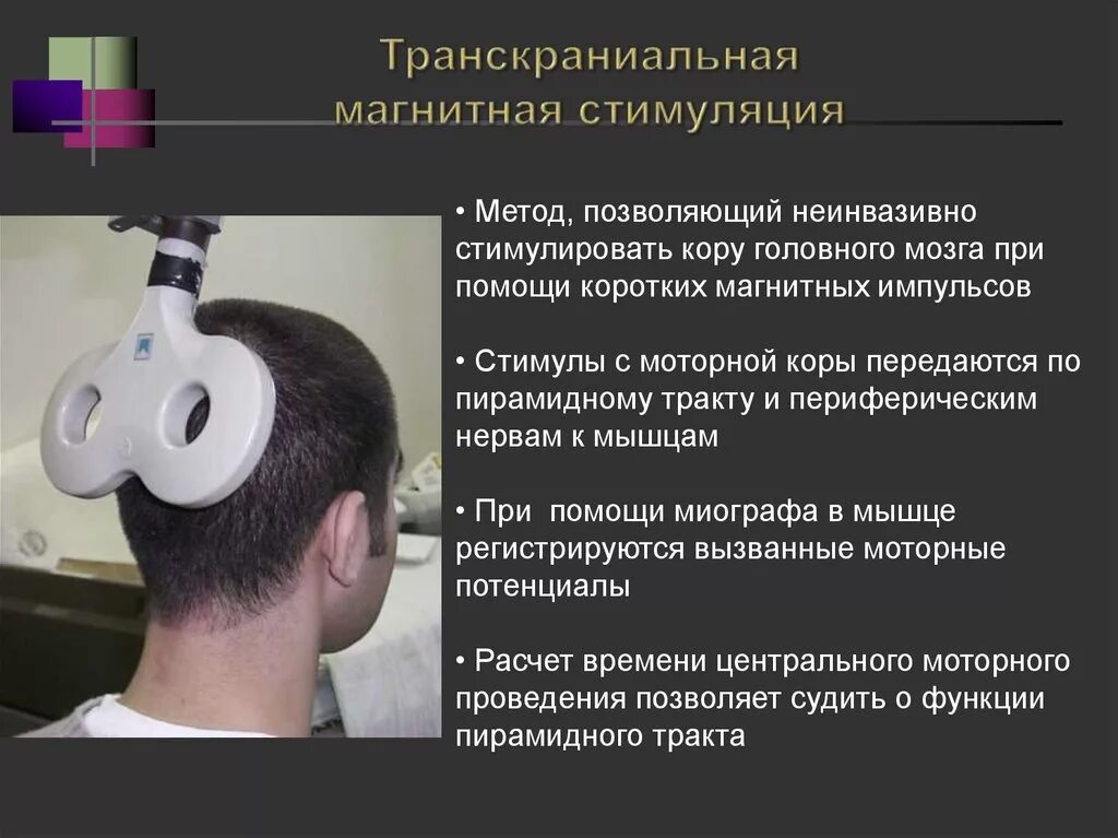 Что означает стимуляция. Транскраниальная магнитная стимуляция (ткмс). методика транскраниальной магнитной стимуляции. трансмагнитная стимуляция головного мозга. магнитная стимуляция эмг.
