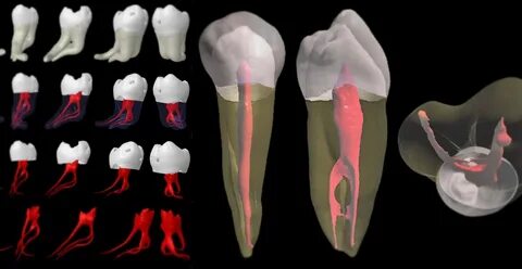 Comment tuer le nerf de la dent ? - PlaneteFemmes : Magazine d