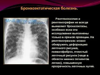 Диффузная деформация